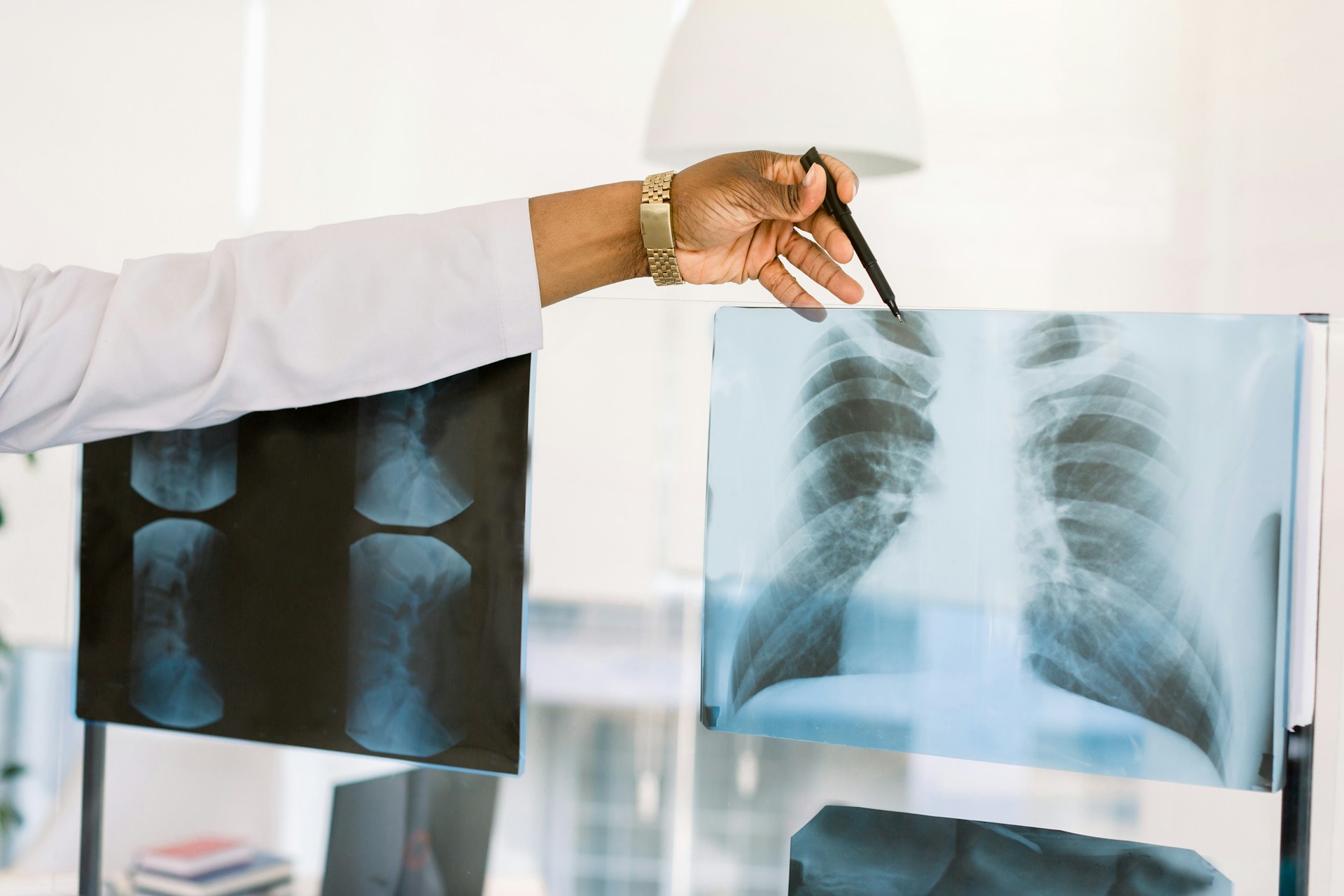 a doctor pointing at an x-ray